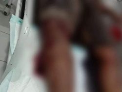 Lakalantas Akibat Dipengaruhi Miras, 3 Orang Luka Berat