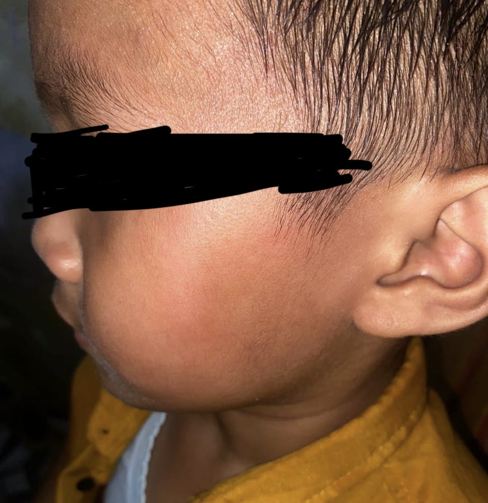 2 Bulan Kasus Pemukulan Anak Dibawah Umur: Tidak Ada Titik Terang Di Polrestabes makassar